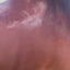 Skin Lotion